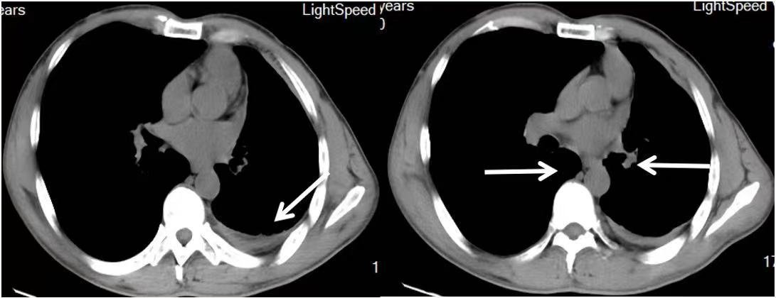 绁炶嵂鍥戒骇,鑽鎵撴灦鐗囨