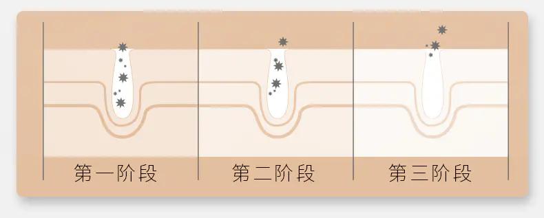 能放进包包的“美容院”，随时淡纹护眼，素颜美女少不了它