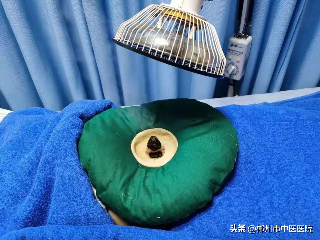 济南治月经不调中医哪里好,月经不调中医把脉什么意思