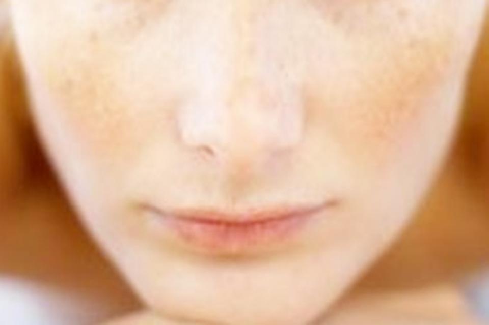 孕期脸上长斑的原因与调理,孕期脸上斑越来越多原因