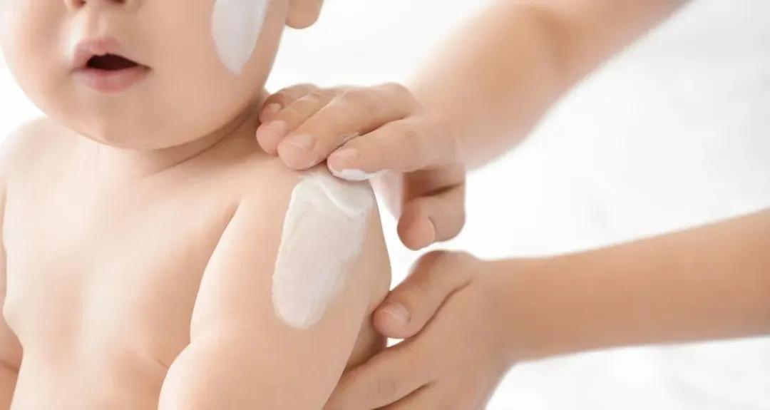 小孩子得湿疹用什么药膏没有激素,小孩湿疹抹了激素药膏皮肤白一块