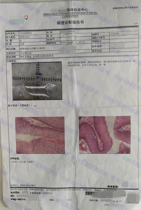 男性发现尖锐性湿疣该看什么门诊,女性有尖锐性湿疣男性会得吗