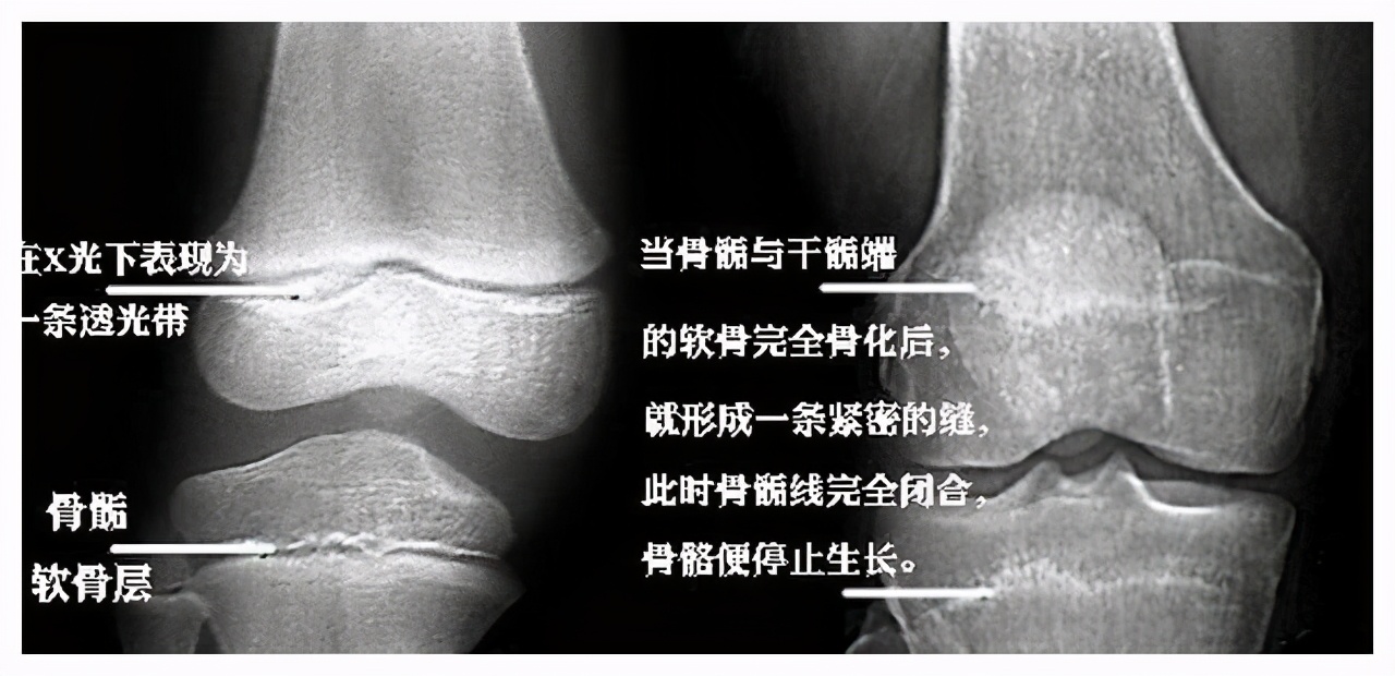 女生崴脚把脚踝扭伤了,25岁已婚姑娘脚扭伤