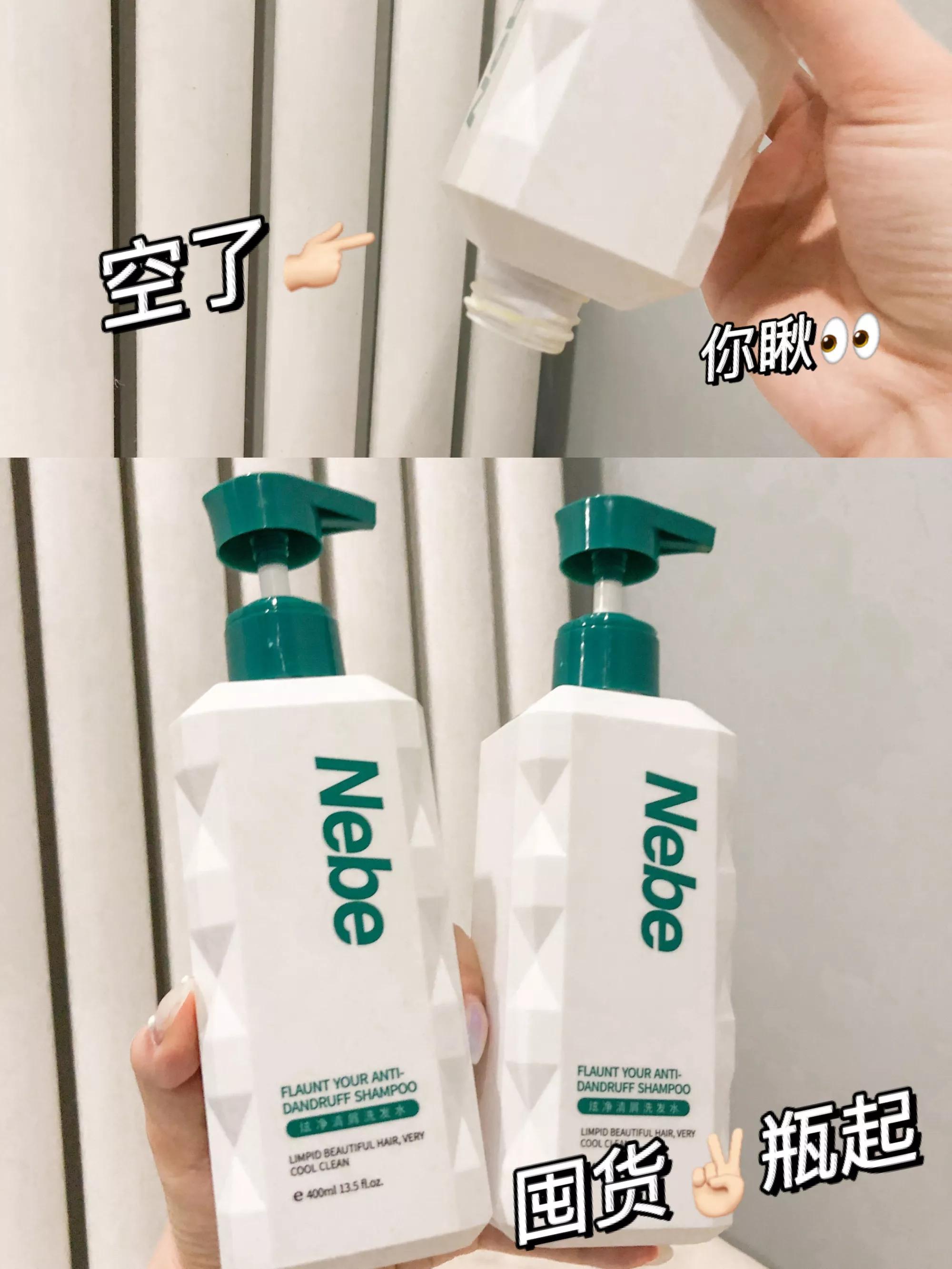 为什么从来没有头屑,你还在为头屑而烦恼吗