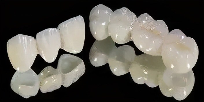 三甲医院全瓷牙保质期,全瓷牙有缝隙保质期是多久