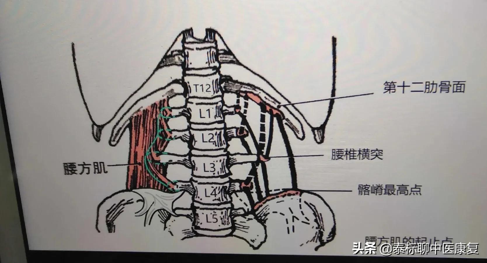颈椎横突针刀松解术能有效果吗,针刀松解脊柱
