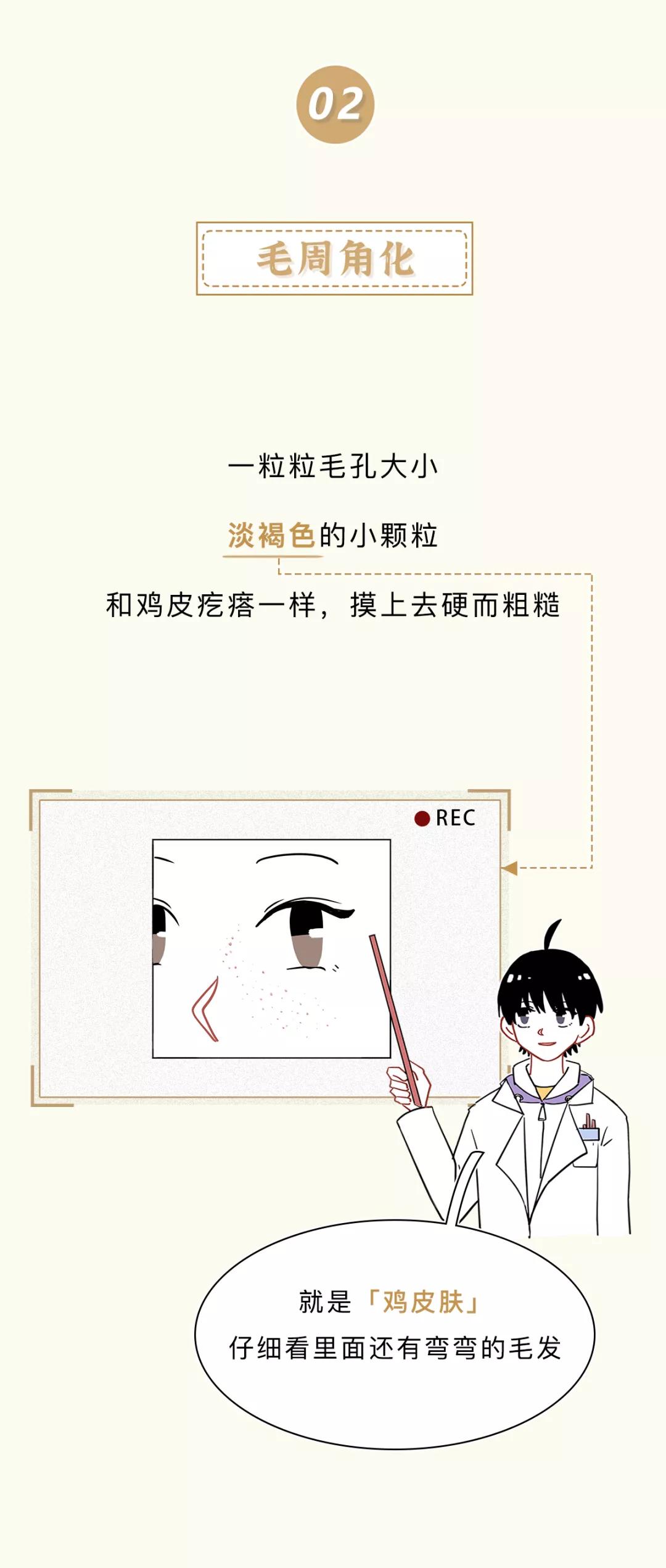 眼睛周围的脂肪粒到底是啥,眼睛周围长了脂肪粒怎么办