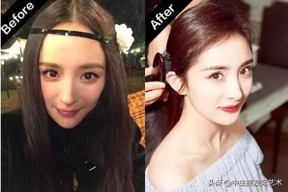 发际线最简单的补救方法,怎么有效的修复发际线