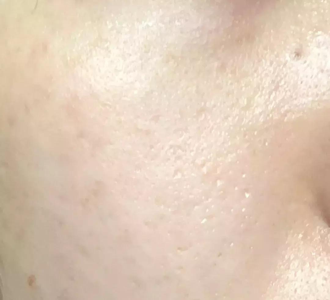 晚上睡觉前涂很多护肤品好吗,晚上必须睡前涂护肤品吗