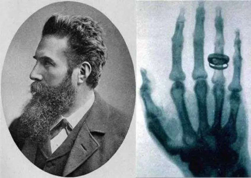 做ct是全身有辐射吗还是局部辐射,坐飞机的辐射和做ct的辐射一样吗