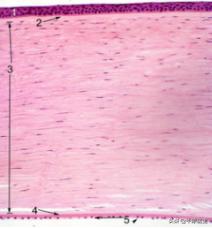 小孩被玩具枪伤,孩子被玩具枪打伤皮肤怎么办