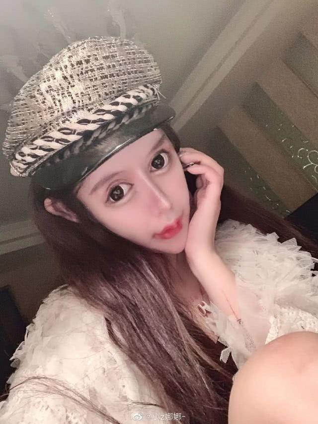 做6次双眼皮4次鼻子，下巴似铁锥眼睛整成球，16岁就整成这样好吗