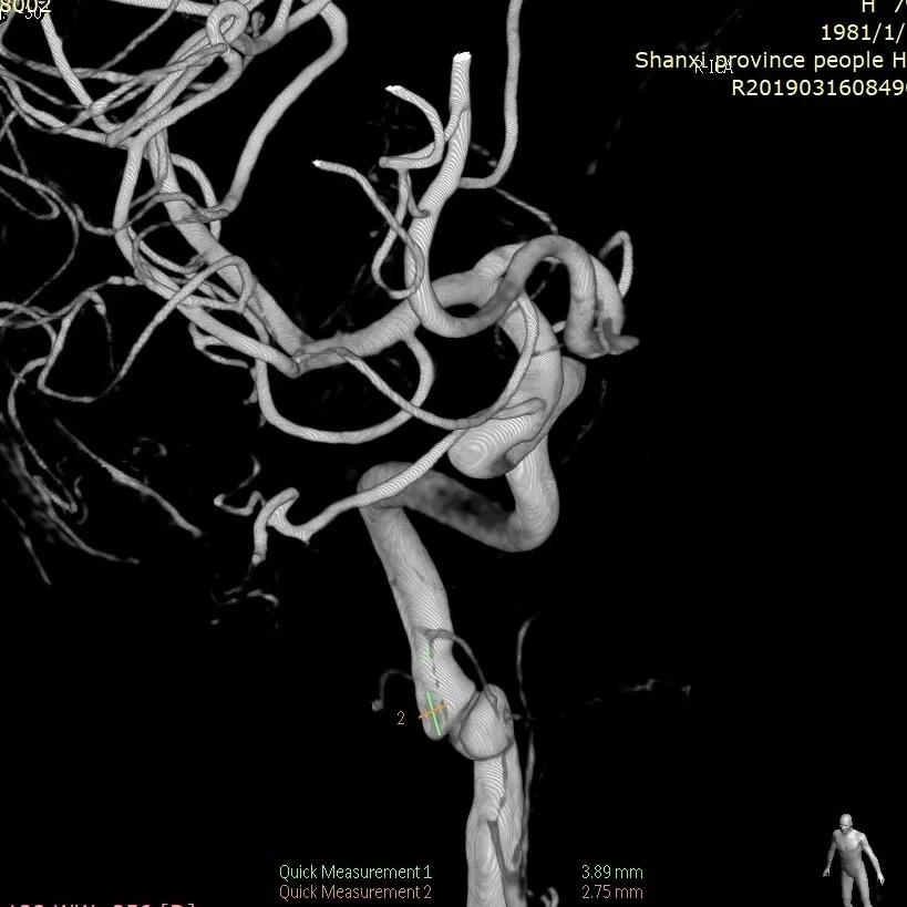 山西省人民医院任少华教授,山西省人民医院任少华