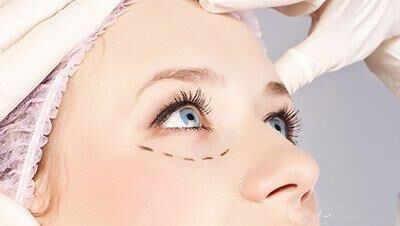 为什么不建议女人割“双眼皮”?主要有这4方面原因,庆幸没跟风