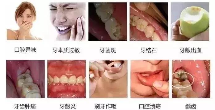 一口黄牙能洗白吗,一口黄牙毁了一张脸