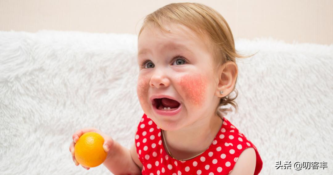 婴儿食物过敏一般多久表现出来,儿童食物过敏的表现和危害