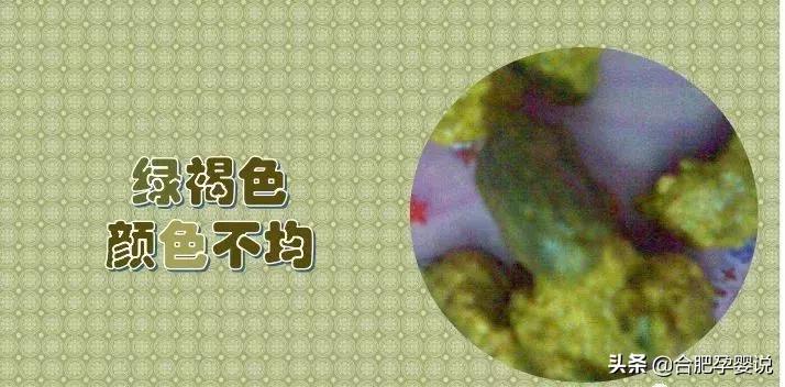 小宝宝拉绿屎怎么了,老话说宝宝拉绿屎怎么说