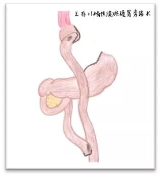 虚胖和实胖怎么减肥,实胖虚胖一起解决