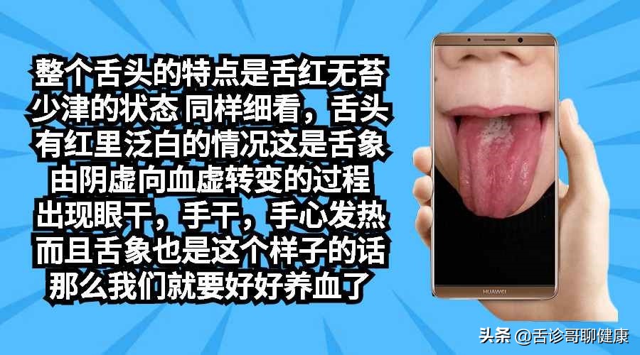 舌诊哥舌象分析阳虚体质,舌诊歌舌象分析和感悟
