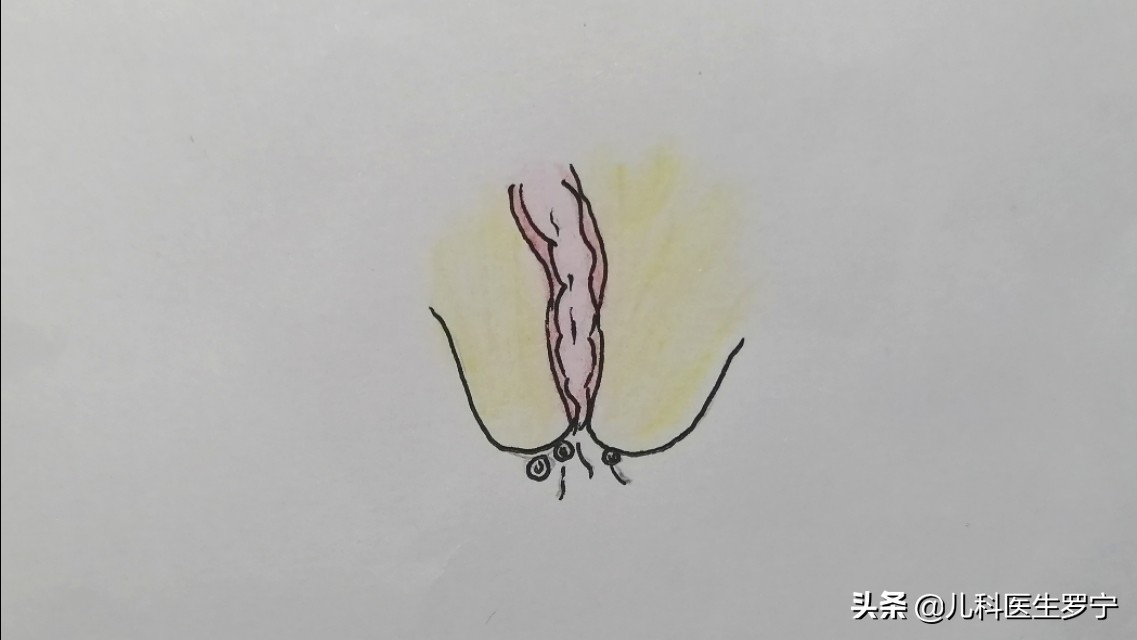 孩子常说屁股痒该做什么检查,孩子总说屁股痒需要驱虫吗