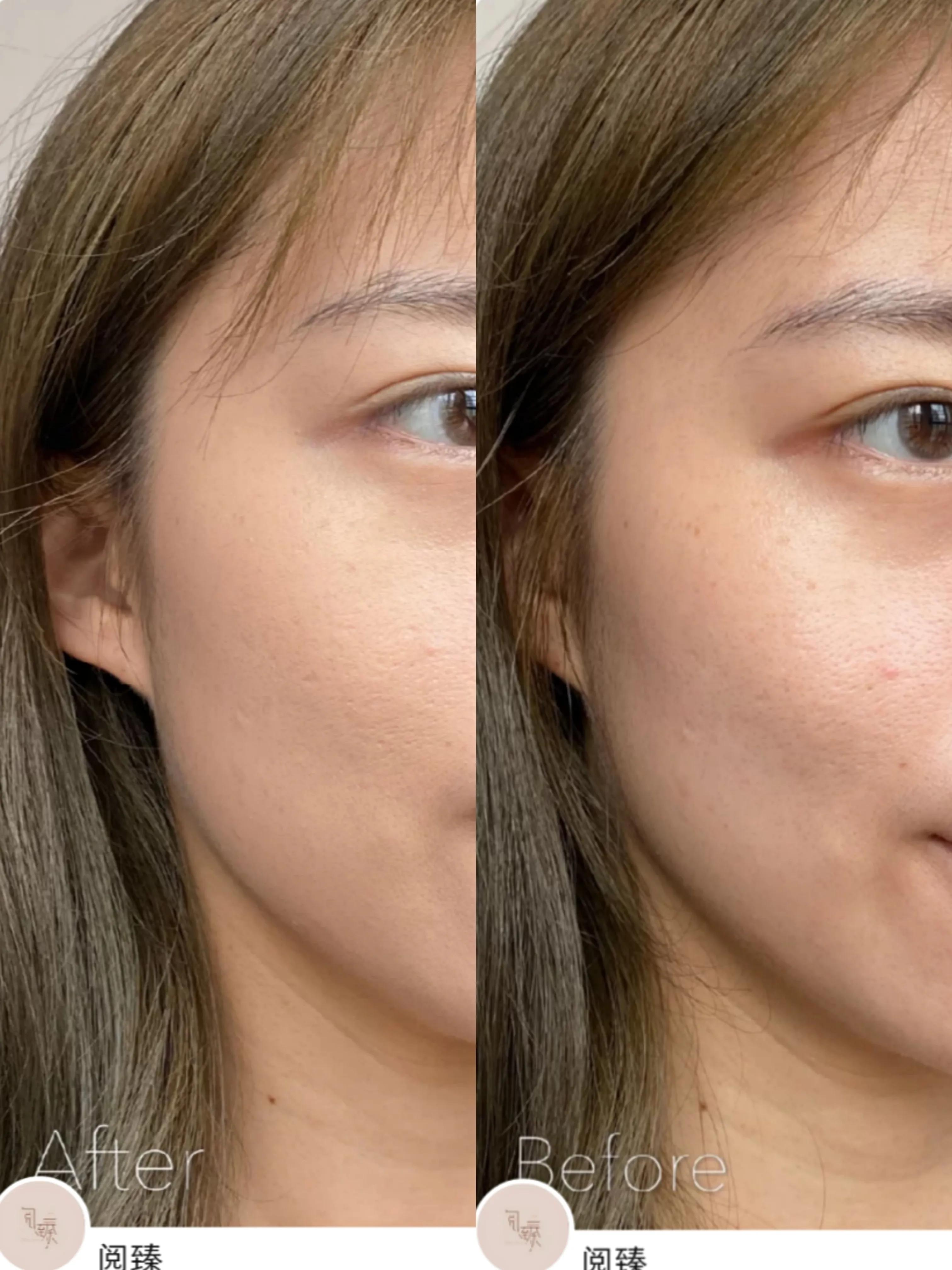 100左右的粉底液干皮推荐,100左右粉底液推荐测评