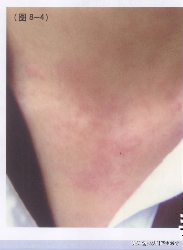 如何防止光老化氧化,预防光老化的最佳方法