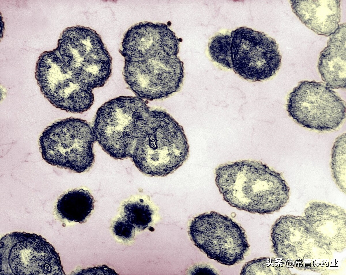 淋病有传染性吗,淋病传染性强么