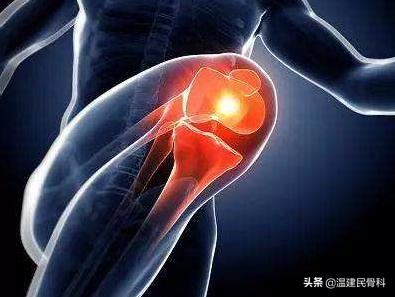 如何诊断膝关节骨性关节炎,膝关节骨性关节炎的判断及治疗