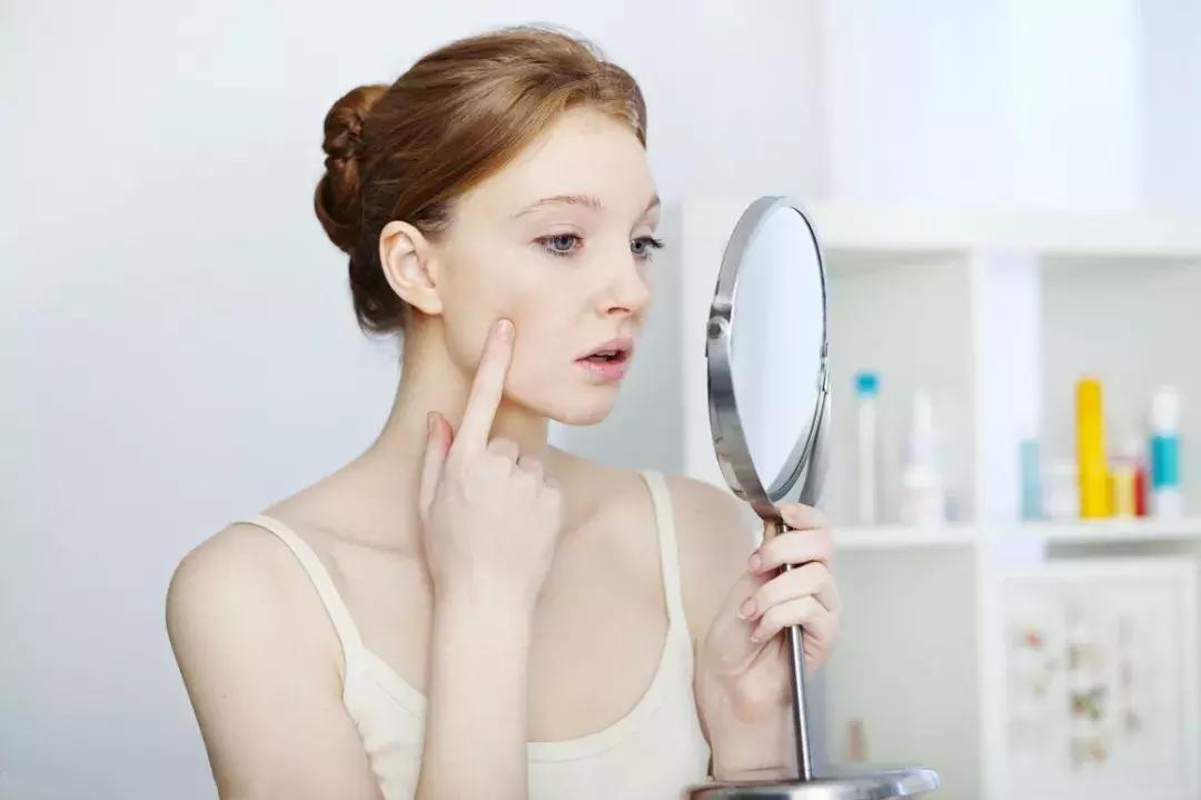皮肤管理丨假期结束，和你一起上班的可能还有痘痘...