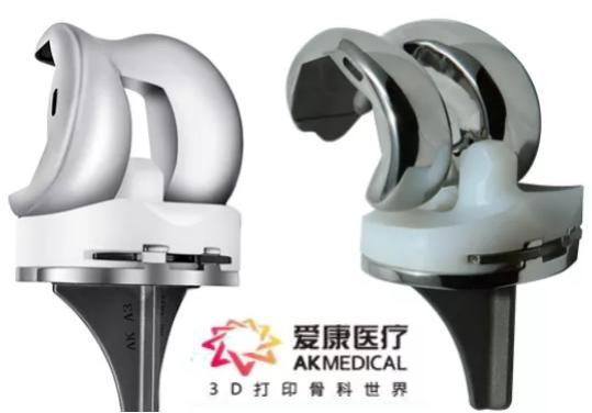 世界首例!我国华西医院成功植入3D打印生物型人工膝关节