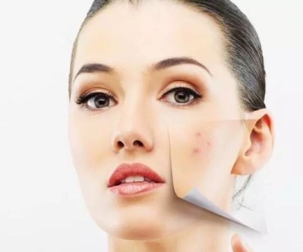 「丽皙白美肤」把闭口粉刺处理好，拒绝痘痘反复出现！