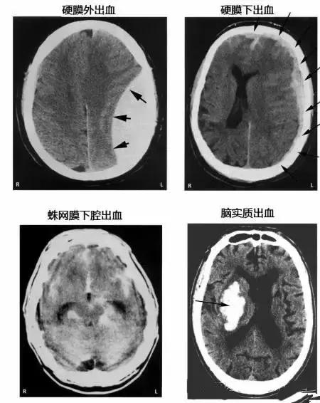 面神经分布图片大全,怎么记住面神经分布