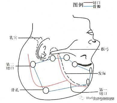 头皮裂伤缝合手术切口分类,头皮切口
