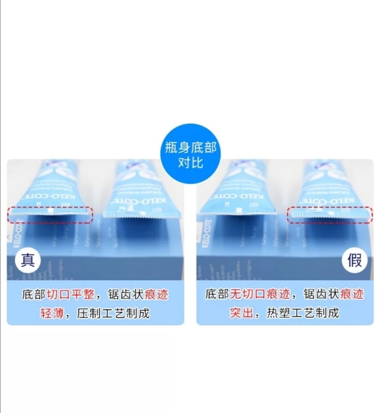 你用过最好的祛疤方法,超好用的祛疤产品