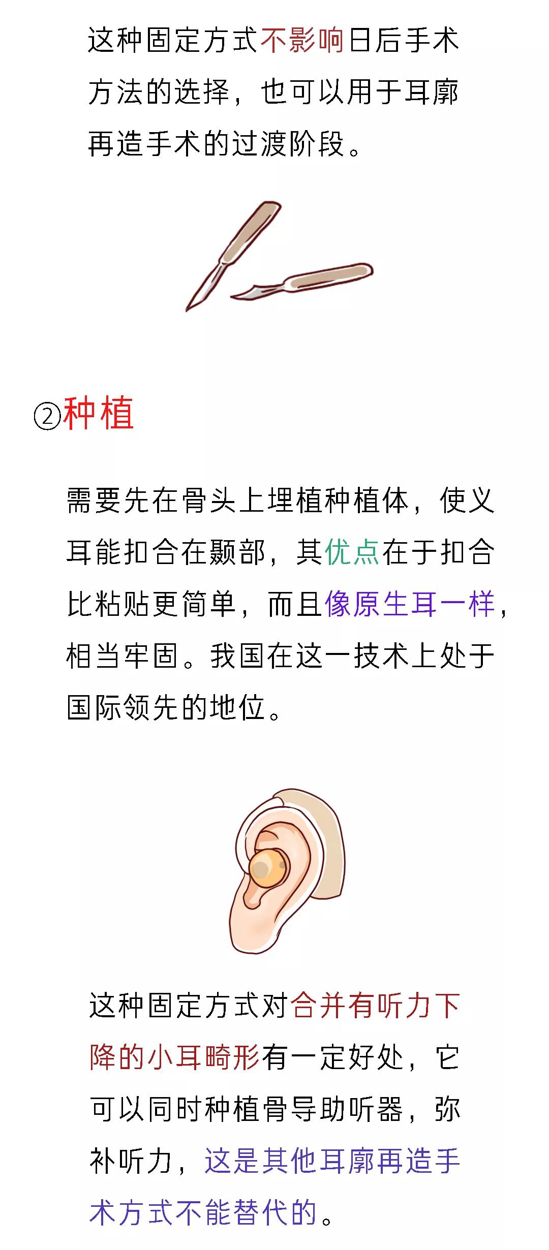 我有一个美丽的愿望伴奏,我有一个美丽的愿望原版