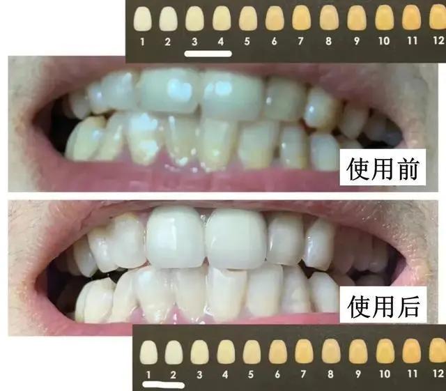 一张嘴就臭,一张嘴就口臭小妙招