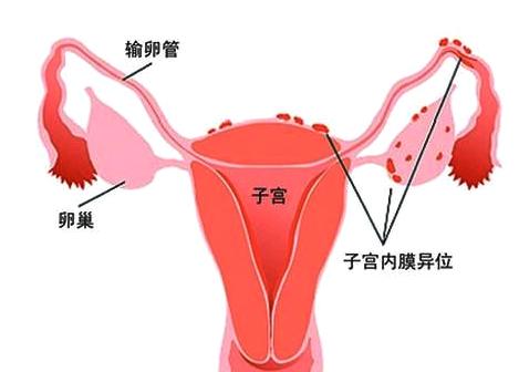 美思伊人:子宫的危害你知道多少吗?