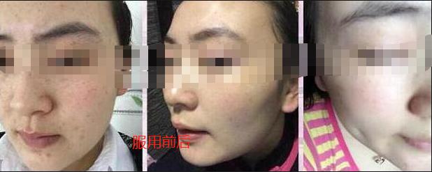 长期抗糖，真的有效果吗？抗糖产品是陷阱，还是神药，专家说别急