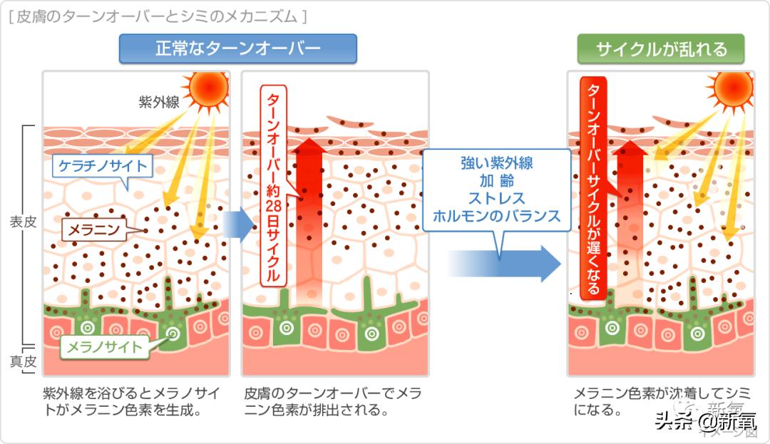 宋祖儿雀斑造型美到窒息,宋祖儿脸上的雀斑一清二楚