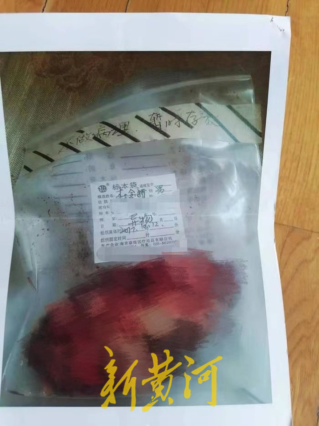 手术后一年大腿伤口感染流脓水,手术过后大腿皮肤溃烂流脓