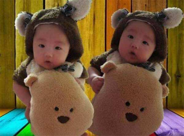 最美胎记小女孩,最美胎记女孩子