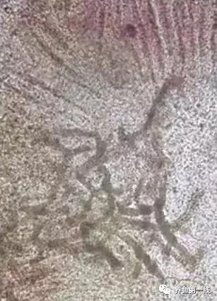 水产鱼鳃虫怎么治疗最好,鱼鳃霉病图片