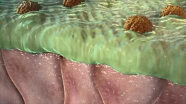 鼻孔会越挖越大吗？挖鼻孔还可能会住进ICU