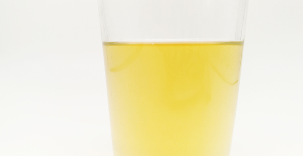 男性尿液过一会浑浊影响生育吗,尿出乳白色会导致不育吗