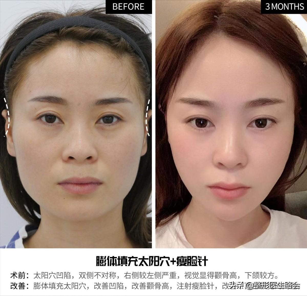 这6个坏习惯会让你越来越胖,这6种坏习惯会毁了孩子一生