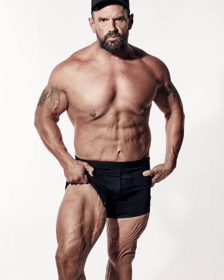 减肥后皮肤松弛怎么调理图解,如何解决减肥后皮肤松弛的问题