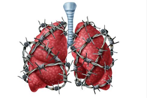 怎样知道自己的肺健不健康,如何判断自己的肺是否健康
