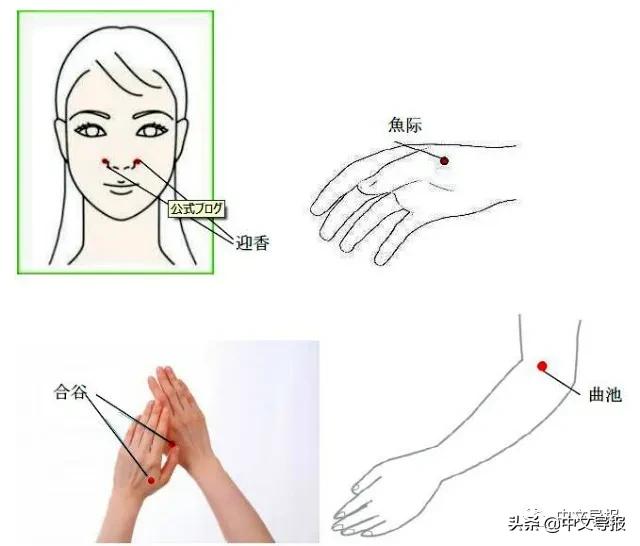 中医防疫专栏,中医针灸抗击疫情立竿见影