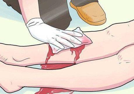 下肢静脉曲张不治后果,聚桂醇治疗下肢静脉曲张