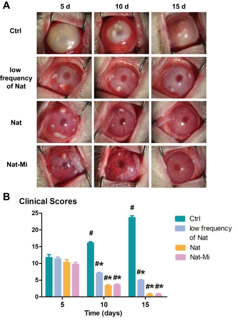 哈医大一院眼科医院院长张弘,哈医大眼科张弘教授